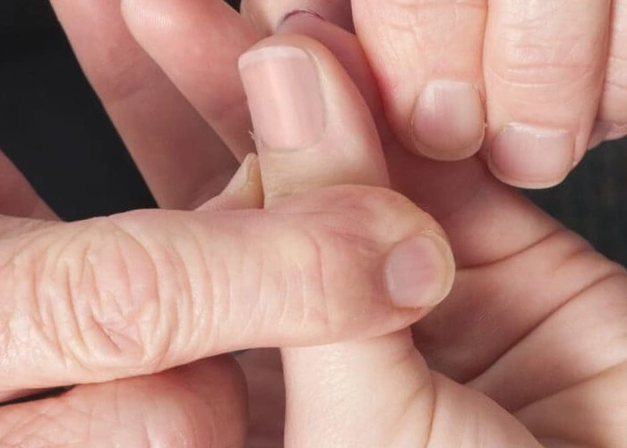 carpal-tunnel-syndrome